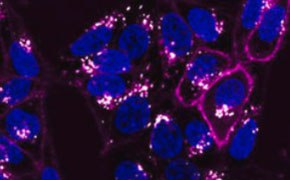 A microscopic image showing multiple cells with distinct blue nuclei surrounded by a network of pink structures, set against a dark background, highlighting the intricate details of cellular components. A microscopic image showing multiple cells with distinct blue nuclei surrounded by a network of pink structures, set against a dark background, highlighting the intricate details of cellular components.