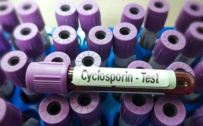 Tubos de ensaio de ciclosporina com tampas roxas