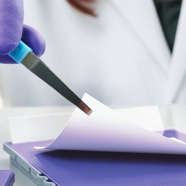 Transfer of proteins to PVDF membrane for detection using Western blotting techniques. Transfer of proteins to PVDF membrane for detection using Western blotting techniques.