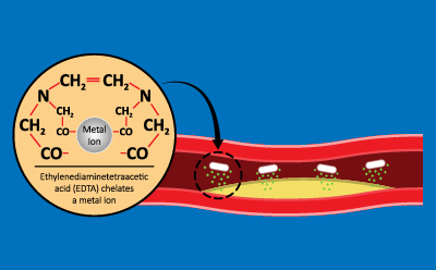 Chelating agent 혈류에서의 EDTA 킬레이트 금속 이온 예시 이미지