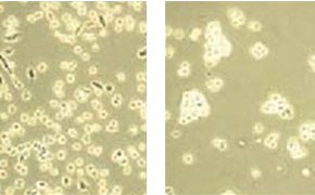 The image presents a comparative microscopic view of cells, with the left section showing a dense cluster of small, irregularly shaped cells, and the right section displaying larger, more defined cells that are sparser in distribution. 