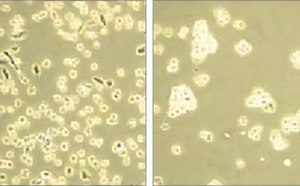 This image presents a comparative microscopic analysis of cellular structures, showcasing two distinct photomicrographs. On the left, a dense aggregation of cells or microorganisms is observed, indicative of a possibly active growth environment. The right photomicrograph reveals a sparser distribution, potentially reflecting the impact of varying experimental conditions on cellular behavior or population density. 