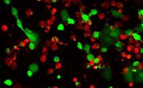 Live/dead cell double staining Live/dead cell double staining