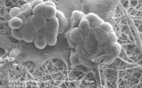cells-grown-nanofiber-structural-insert-290x180.jpg