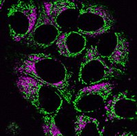 Live HeLa cells co-stained with BioTracker NIR650 Lysosome Dye (SCT139) and BioTracker 488 Green Mitochondria Dye (SCT136) Cellules HeLa vivantes co-colorées avec le colorant pour lysosomes BioTracker NIR650 et le colorant vert pour mitochondries BioTracker 488.