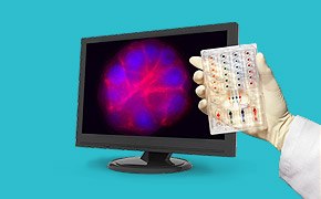 A close-up of a hand in a latex glove holding a transparent plastic device with colored indicators, positioned in front of a computer monitor displaying a vibrant, magnified image of a cell structure with blue and pink hues, set against a turquoise background.