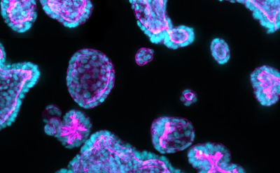 Circular and oval organoids are scattered on a black background. The organoids are filled with smaller ovals that represent the individual cells. Circular and oval organoids are scattered on a black background. The organoids are filled with smaller ovals that represent the individual cells.