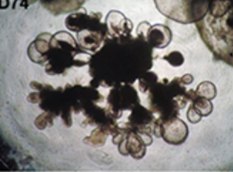 Lung organoids cultured with the 3dGRO™ Human Lung Organoid Culture System Human iPSC-derived lung organoids, cultured with the 3dGRO™ Human Lung Organoid Culture System