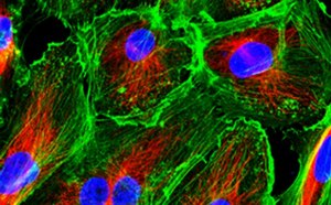 Primary cells in culture