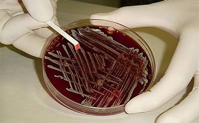 Biochemical tests integrated on strips, discs, and membranes for easy use