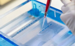 Nucleic Acid Electrophoresis & Hybridization
