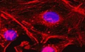 Example of immunocytochemistry staining using a primary antibody, anti-beta-actin antibody. Primary antibodies