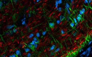 Antibodies