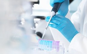 Scientist in a lab working with samples and an electronic pipette Scientist in a lab working with samples and an electronic pipette