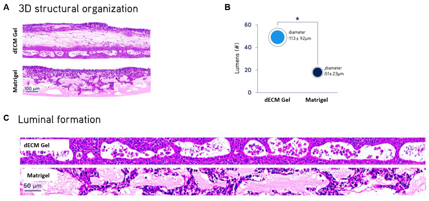 Air liquid interface (ALI) cultures of primary normal human bronchial epithelial (NHBE) cells after 21 days. NHBE cells cultured in Lung dECM Hydrogels formed more organized and complex stratified luminal structures recapitulating the cellular architecture of the human airway, with significantly larger average diameter compared to Matrigel® matrix.