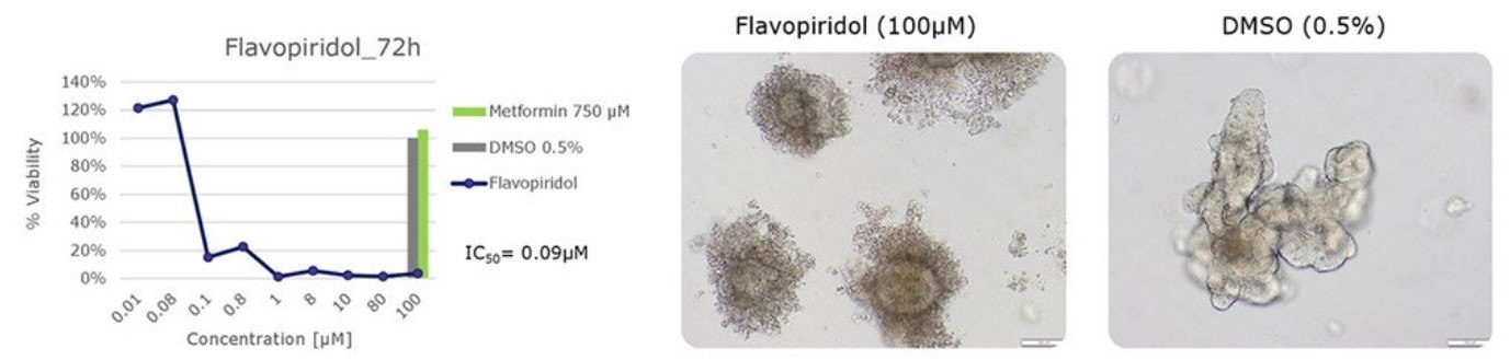 Microscopy images of human colon organoids testing cytotoxicity of flavopiridol. IC50 of flavopiridol in human colon organoids.