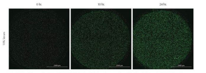 Kinetic images taken of Green-labeled MDA-MB-231 cells labeled prior to experiment with CellTracker™ Green CMFA dye. 10% or 0% serum was used as positive and negative chemoattractant controls, respectively. Images captured using GFP imaging filter cube and a 4X objective.