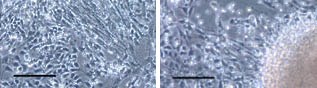 EB Selection in defined medium. Morphology of putative NSCs produced from iPSCs cells by various protocols. Scale bar: 100 µm. EB Selection in defined medium. Morphology of putative NSCs produced from iPSCs cells by various protocols. Scale bar: 100 µm.