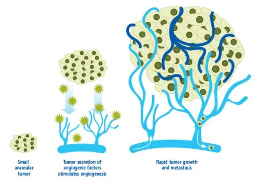 Angiogenesis in Cancer