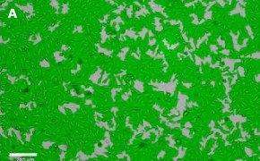 Brightfield imaging of OSUMMER.10 cells on Millicell<sup>®</sup> DCI Digital Cell Imager at 10X magnification Brightfield imaging of OSUMMER.10 cells on Millicell<sup>®</sup> DCI Digital Cell Imager at 10X magnification