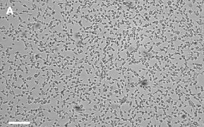 Brightfield imaging of OSUMMER.11 cells on Millicell<sup>®</sup> DCI Digital Cell Imager at 10X magnification Brightfield imaging of OSUMMER.11 cells on Millicell<sup>®</sup> DCI Digital Cell Imager at 10X magnification