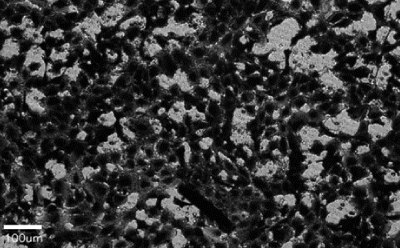 Brightfield image of a cell migration assay presence, showing the heavy cell staining. A 100 µm bar is shown for scale. Brightfield image of a cell migration assay presence, showing the heavy cell staining. A 100 µm bar is shown for scale.