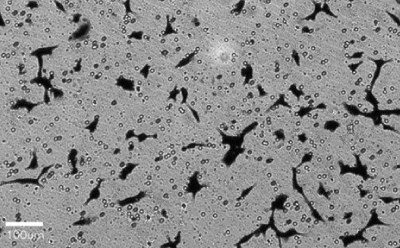 Brightfield image of cells with little cell staining. A 100 µm bar is shown for scale. Brightfield image of cells with little cell staining. A 100 µm bar is shown for scale.