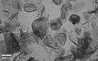 Brightfield image showing fragmented organoids appearing with cell debris, with 200 µm bar for scale. Brightfield image showing fragmented organoids appearing with cell debris, with 200 µm bar for scale.