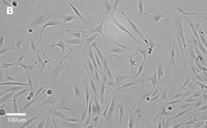 Brightfield imaging of MDCK cells on Millicell<sup>®</sup> DCI Digital Cell Imager at 20X magnification Brightfield imaging of MDCK cells on Millicell<sup>®</sup> DCI Digital Cell Imager at 20X magnification