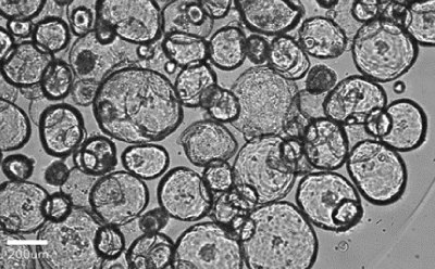 Brightfield image showing round organoids of various sizes, with 200 µm bar for scale. Brightfield image showing round organoids of various sizes, with 200 µm bar for scale.