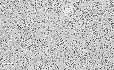 A brightfield image of suspension cells appearing as tiny, dark dots across the imaging field. A 200 µm bar is shown for scale. A brightfield image of suspension cells appearing as tiny, dark dots across the imaging field. A 200 µm bar is shown for scale.