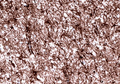 Immunohistochemical staining of the human cerebral cortex shows strong cytoplasmic positivity in astrocytes.