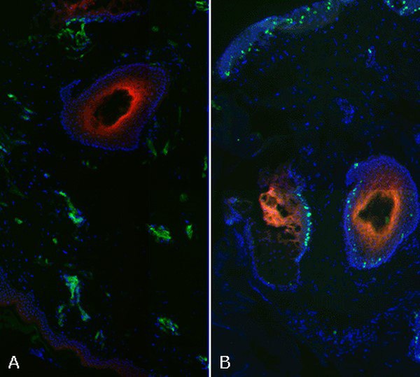 Hypoxia detection in fixed tissue.