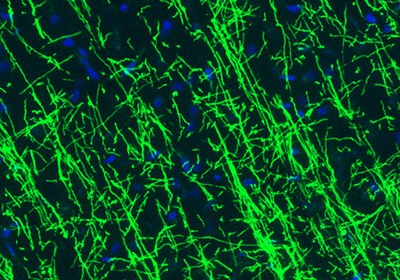 Immunofluorescence staining of rat hippocampus shows strong positivity of the astrocytes.