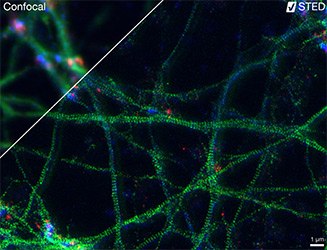 Three-color STED image of primary hippocampal neurons imaged with the Abberior<sup>&reg;</sup> Instruments Expert Line STED microscope.