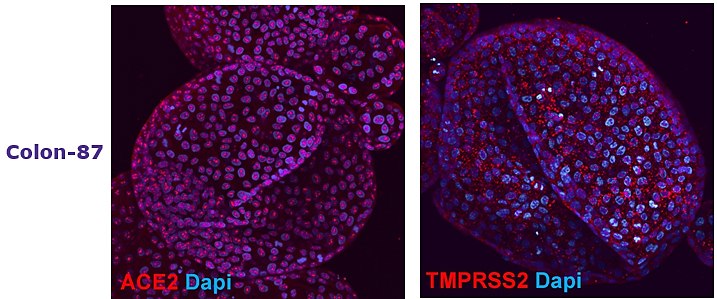 Adult tissue derived colon (SCC321, Colon-87) and duodenum (SCC320, DUO-85) organoids express SARS-CoV-2 related proteins ACE2 and TMPRSS2.