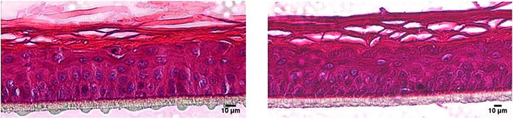 Hematoxylin/eosin staining of RhE models cultivated in the cell culture Insert 2in1 (right) and in an insert from another manufacturer (left). Human derived keratinocytes develop a stratified epidermis with a multilayered stratum corneum. Hematoxylin/eosin staining of RhE models cultivated in the cell culture Insert 2in1 (right) and in an insert from another manufacturer (left).