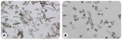 Photomicrographs of isolated cardiomyocytes prepared with water A (A) or water B (B). Images courtesy of Drs. C. Plin and R. Zini, INSERM U660, Créteil School of Medicine, France. Photomicrographs of isolated cardiomyocytes prepared with freshly purified and ultrafiltered water (A) or stored, ultrapure water without ultrafiltration (B). Many more viable cardiomyocytes were obtained in water A, as shown by their elongated and striated shape.