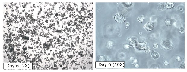 Human PDAC cancer organoid (<a href="/product/mm/scc706">SCC706</a>, PPTO.46) morphology and confluency prior to cryopreservation on day 6 (first image at 2X magnification, second image at 10X magnification). Microscopy images of PDAC organoids before cryopreservation. The first image shows organoids at Day 6 at 2X magnification, with small black circles covering the entirety of the image. The second image shows organoids at Day 6 at 10X magnification, with larger clear circles on a grey background.