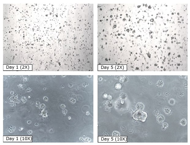 Time course of PDAC cancer organoid growth over a 5-day period shows positive cell proliferation after thaw (<a href="/product/mm/scc700">SCC700</a>, PPTO.02) at 2X (top images) or 10X (bottom images) magnification. Four microscopy images of pancreatic ductal adenocarcinoma organoids over a 5 day period. The first image shows the organoids at Day 1 at 2X, with small black dots covering the entirety of the image. The second image shows the organoids at Day 5 of growth at 2X magnification, with fewer, larger black circles scattered across the image. The third image shows the organoids at Day 1 at 10X magnification, with small clear circles on a grey image background. The fourth image shows the organoids at Day 5 at 10X magnification, with larger and fewer clear circles on a grey image background.
