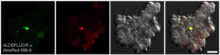 CA/TD murine pancreatic cells co-stained with ALDEFLUOR and AldeRed 588-A