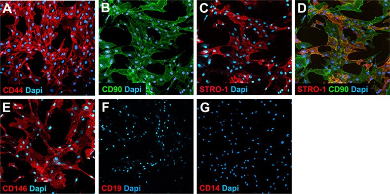 Immunocytochemical staining of cultured human bone marrow-derived mesenchymal stem cells stained