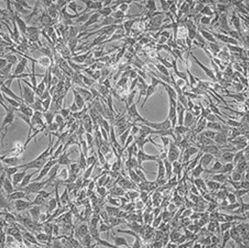 Stromal Cells for T-Cell Differentiation