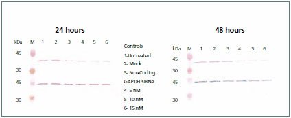 Western blot.