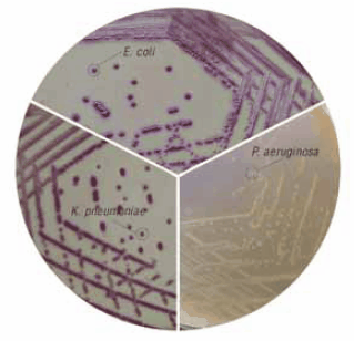 HiCrome™ ECC Agar (73009)