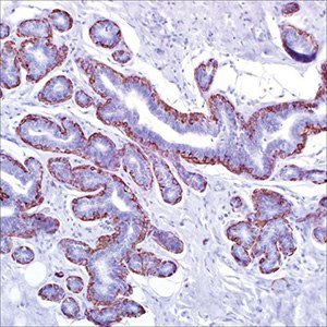 Calponin (CALP) on adenosis of breast