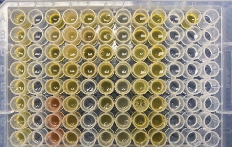 Actual samples for extraction 2 Supel™ BioSPME 96-pin device with actual samples for extraction 2 showing wells loaded with 200 µL of either serum sample (yellow/red) or a calibrator prepared in phosphate buffered saline.
