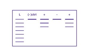 Agarose Gel Electrophoresis Agarose gel electrophoresis