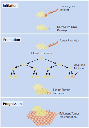 The classical model of carcinogensis proceedes from initiation to promotion and then evolves to progression. See text for further description.