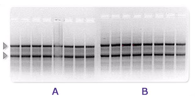Agarose gel electrophoresis of rRNA. Gels and buffers were prepared using either (A) pure or (B) ultrapure water. The band intensities are higher with ultrapure water. Comparison of two agarose electrophoresis gels of rRNA showing higher intensity bands in ultrapure vs pure water